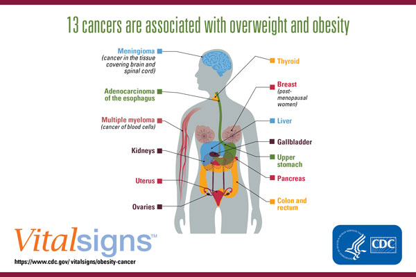 is being fat genetic